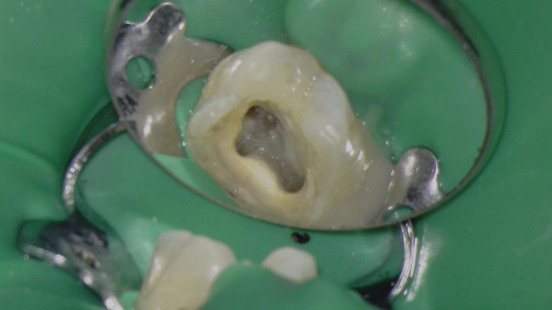 Endodonte