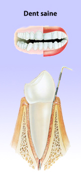 Dent saine